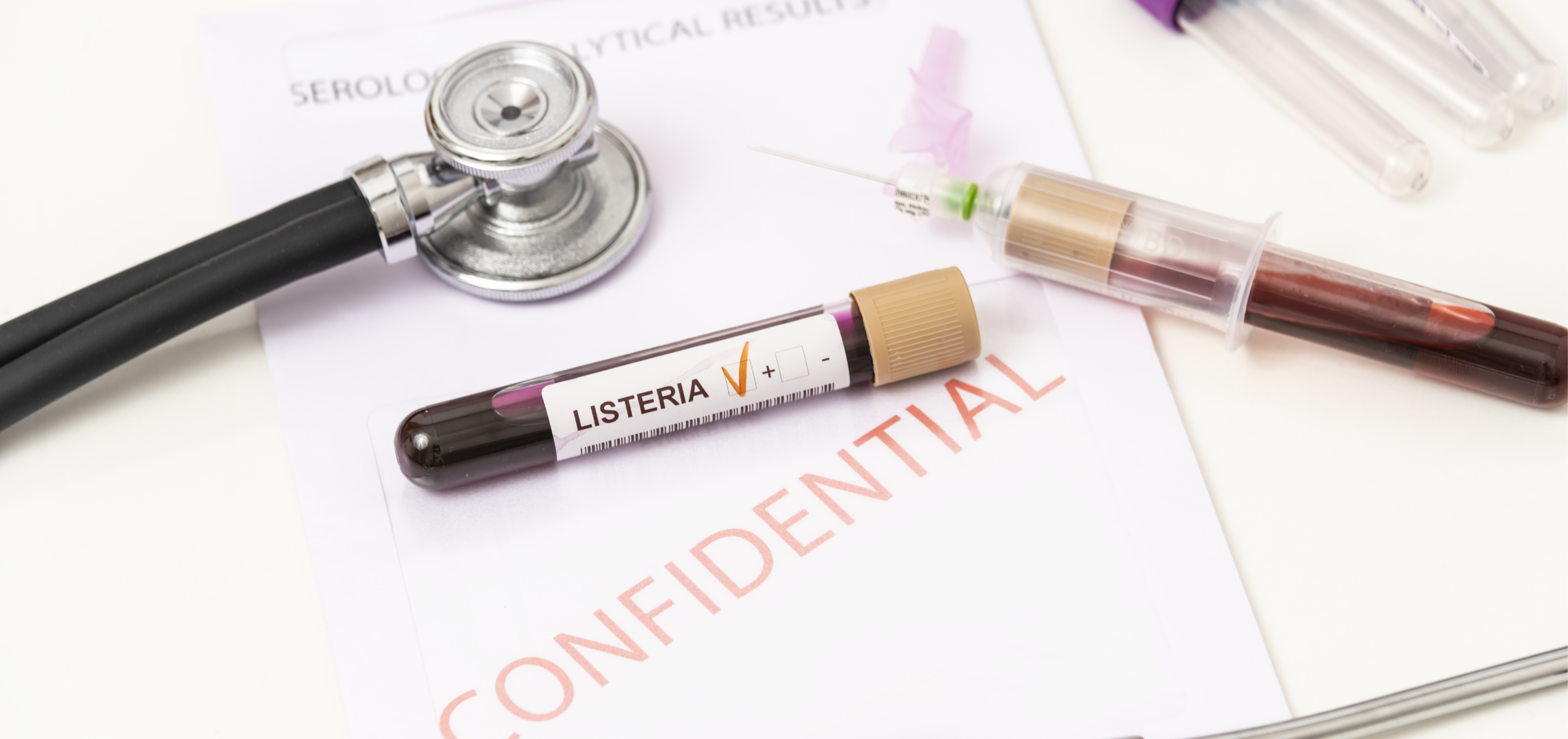 Listeria: Llaman a la prevención para evitar casos en la región